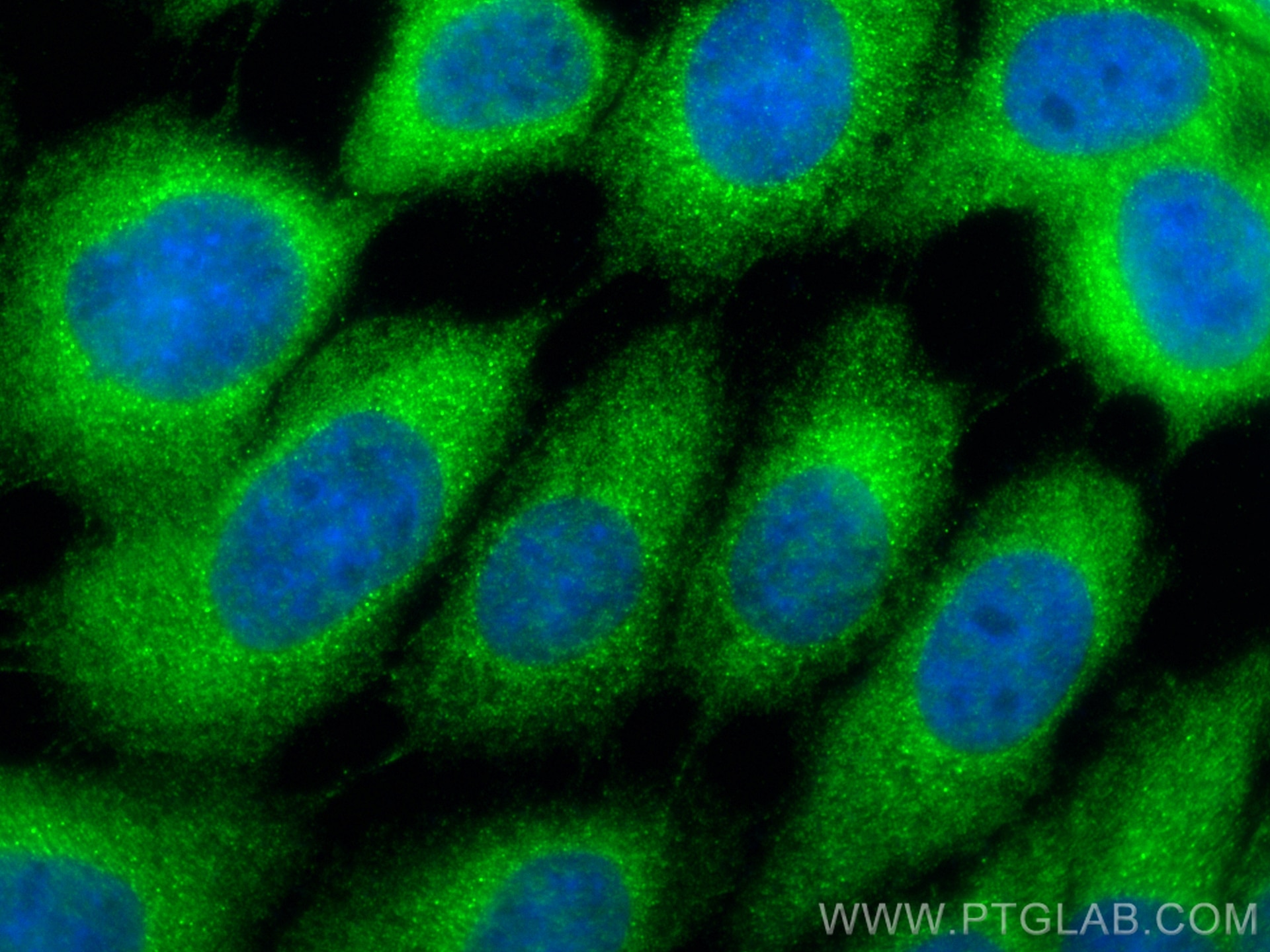 Immunofluorescence (IF) / fluorescent staining of A431 cells using ARHGEF18 Polyclonal antibody (11243-1-AP)