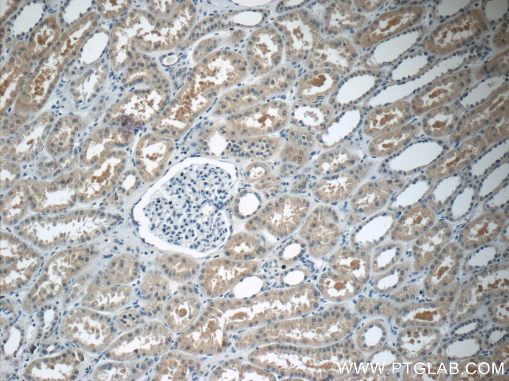 Immunohistochemistry (IHC) staining of human kidney tissue using ARHGEF18 Polyclonal antibody (11243-1-AP)