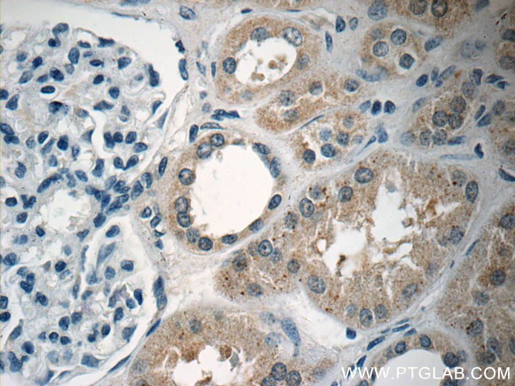 Immunohistochemistry (IHC) staining of human kidney tissue using ARHGEF18 Polyclonal antibody (11243-1-AP)