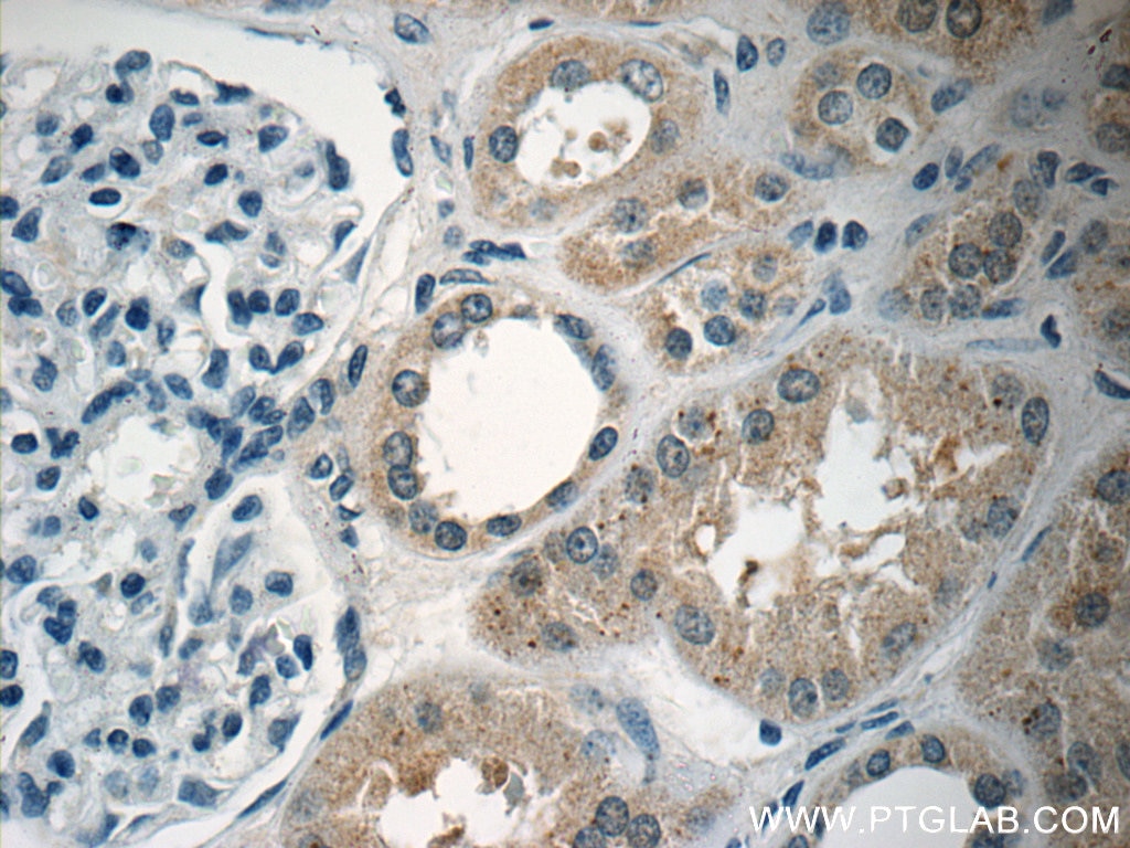 IHC staining of human kidney using 11243-1-AP