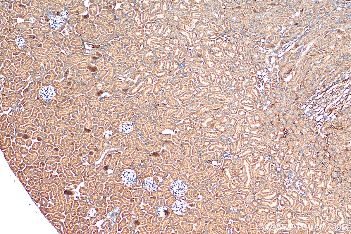 IHC staining of mouse kidney using 11243-1-AP