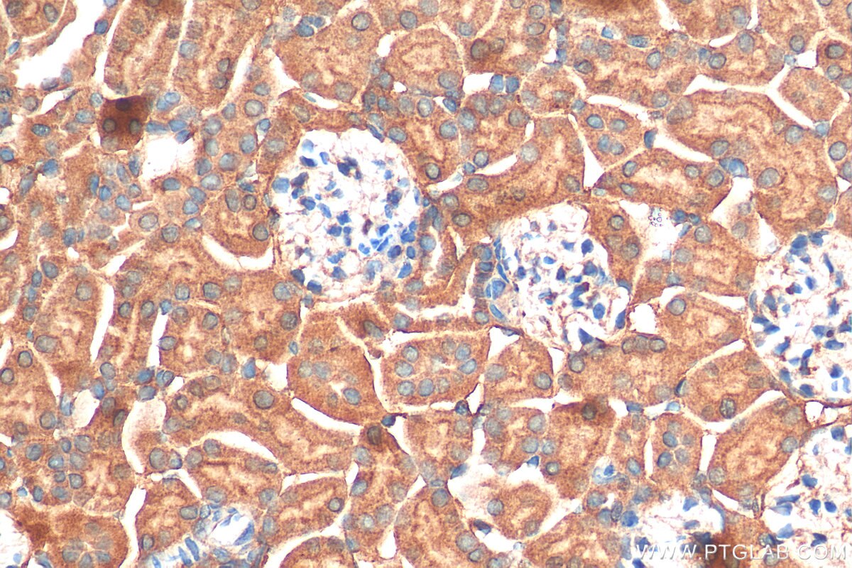 Immunohistochemistry (IHC) staining of mouse kidney tissue using ARHGEF18 Polyclonal antibody (11243-1-AP)