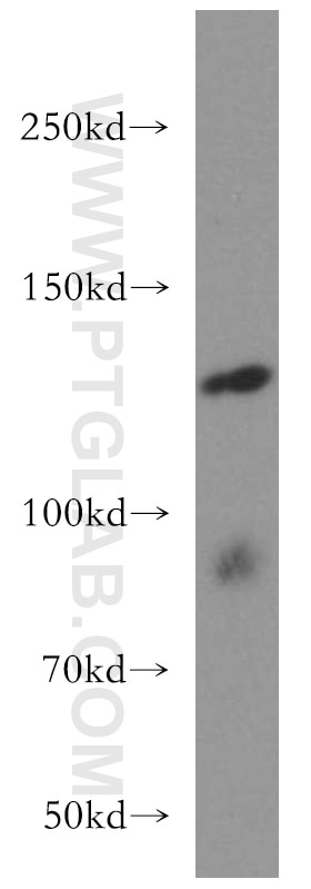 Western Blot (WB) analysis of mouse testis tissue using ARHGEF18 Polyclonal antibody (11243-1-AP)