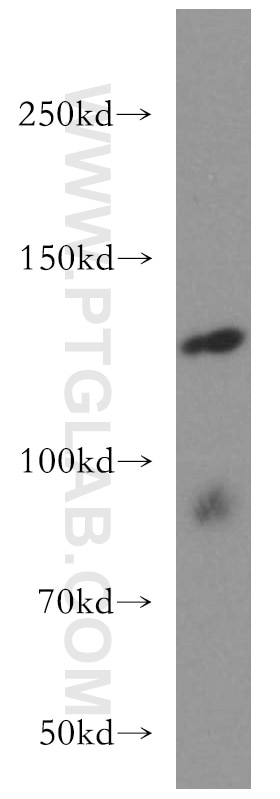 WB analysis of mouse testis using 11243-1-AP