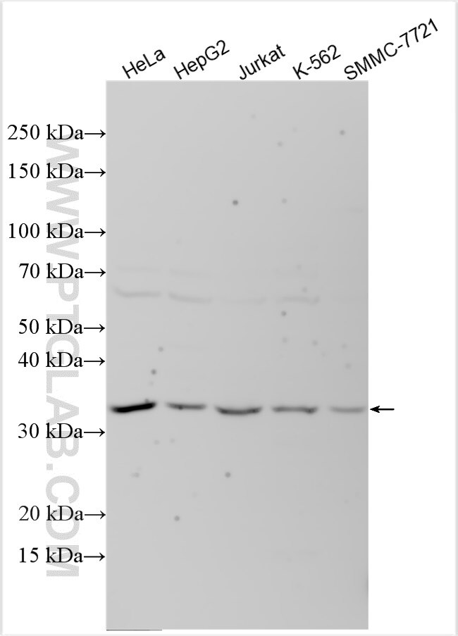 Western Blot (WB) analysis of various lysates using ARHGEF39 Polyclonal antibody (21182-1-AP)