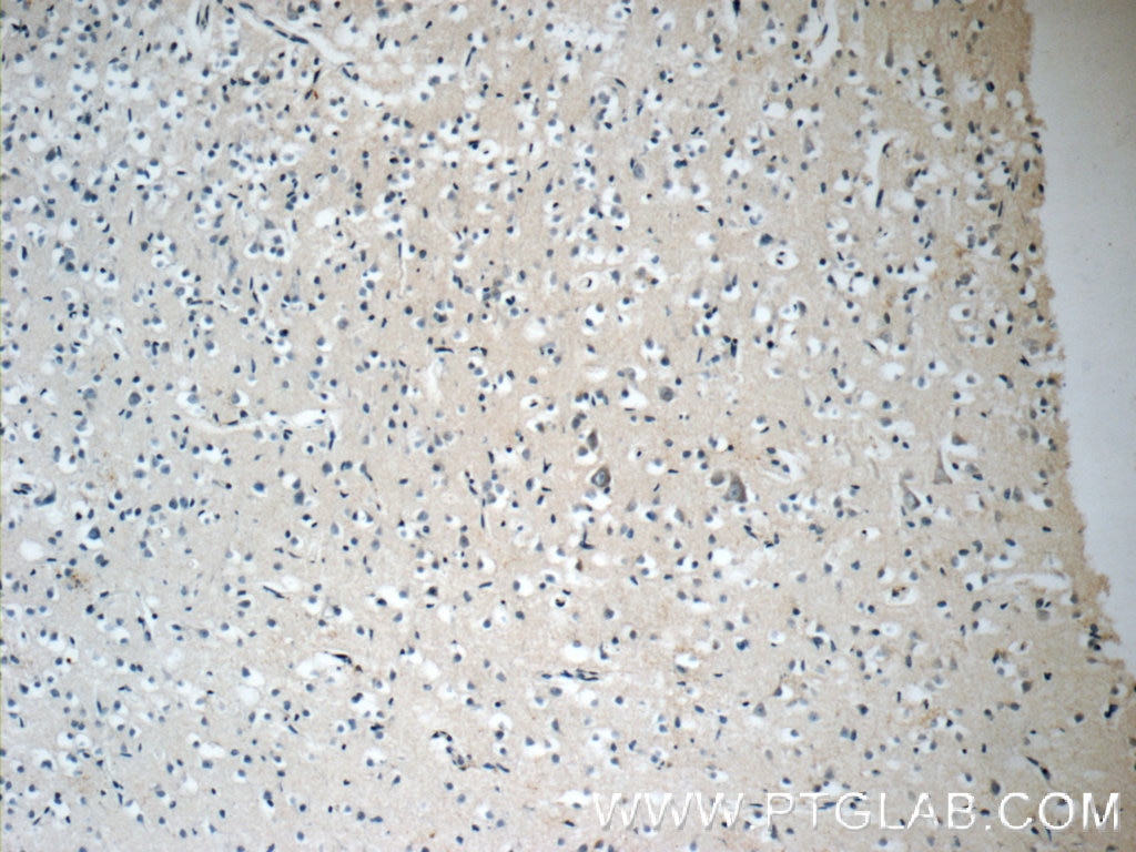 Immunohistochemistry (IHC) staining of human brain tissue using ARHGEF4 Polyclonal antibody (55213-1-AP)