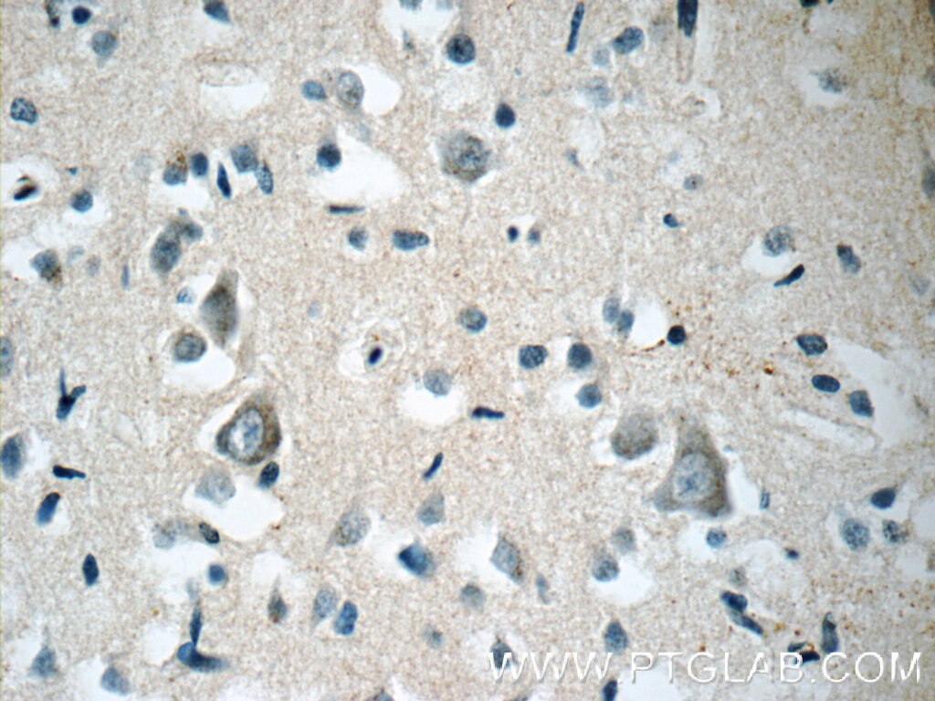 IHC staining of human brain using 55213-1-AP