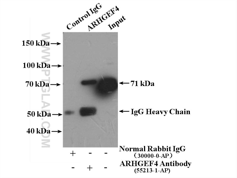 Immunoprecipitation (IP) experiment of mouse brain tissue using ARHGEF4 Polyclonal antibody (55213-1-AP)
