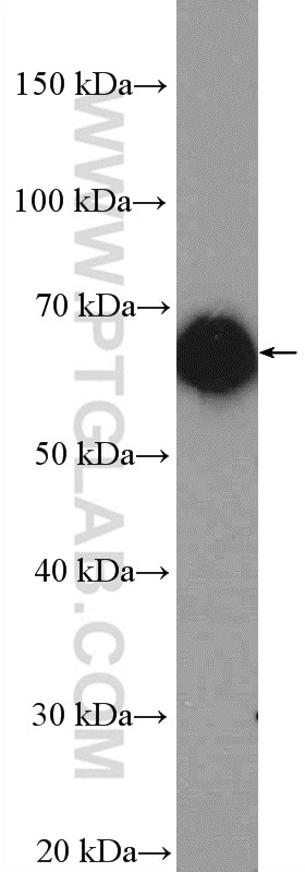 Western Blot (WB) analysis of mouse brain tissue using ARHGEF4 Polyclonal antibody (55213-1-AP)
