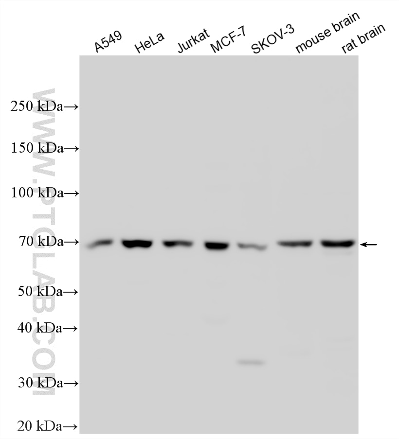 Western Blot (WB) analysis of various lysates using ARHGEF4 Polyclonal antibody (55213-1-AP)