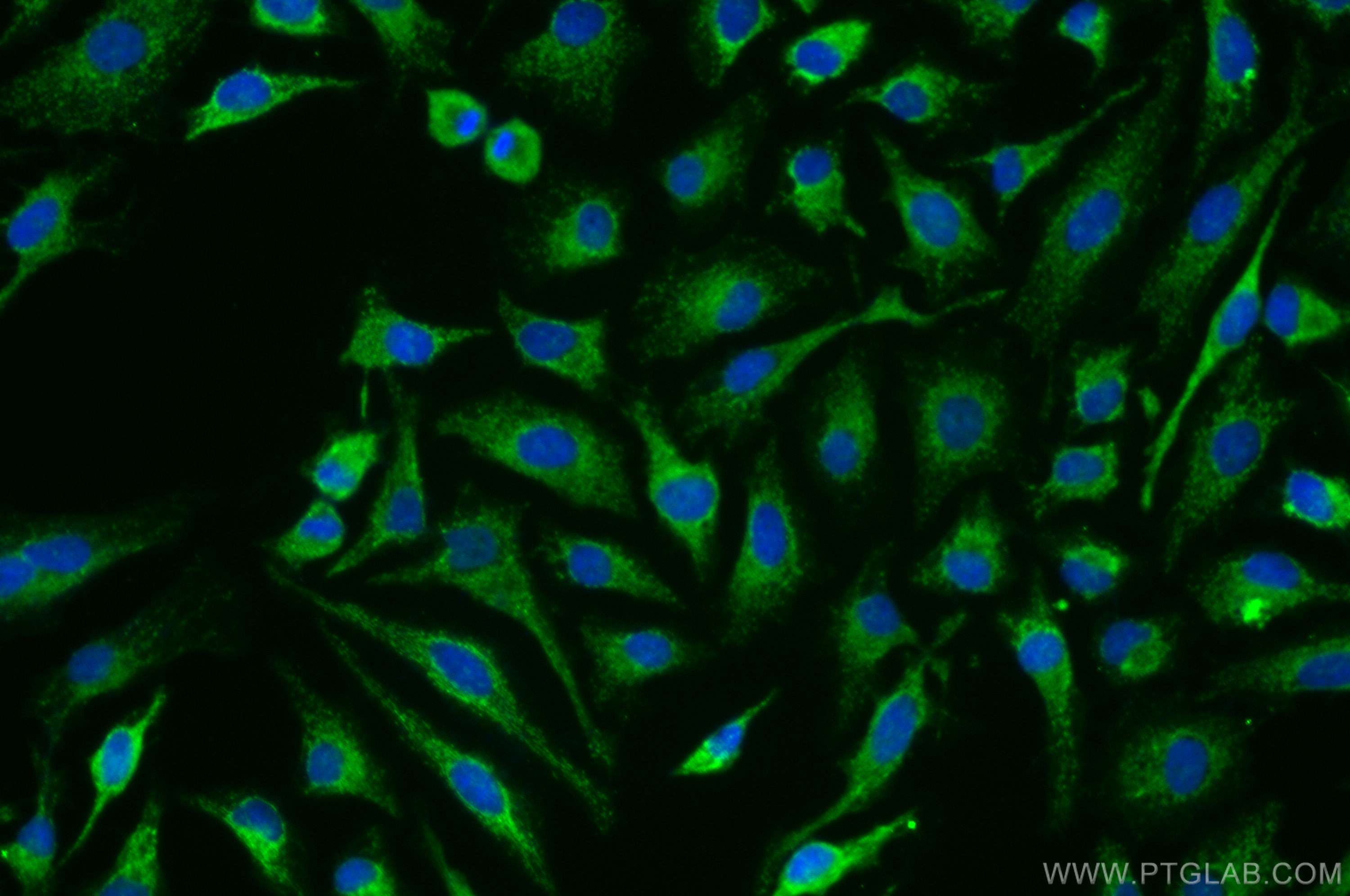 Immunofluorescence (IF) / fluorescent staining of HeLa cells using ARHGEF5 Polyclonal antibody (11379-1-AP)