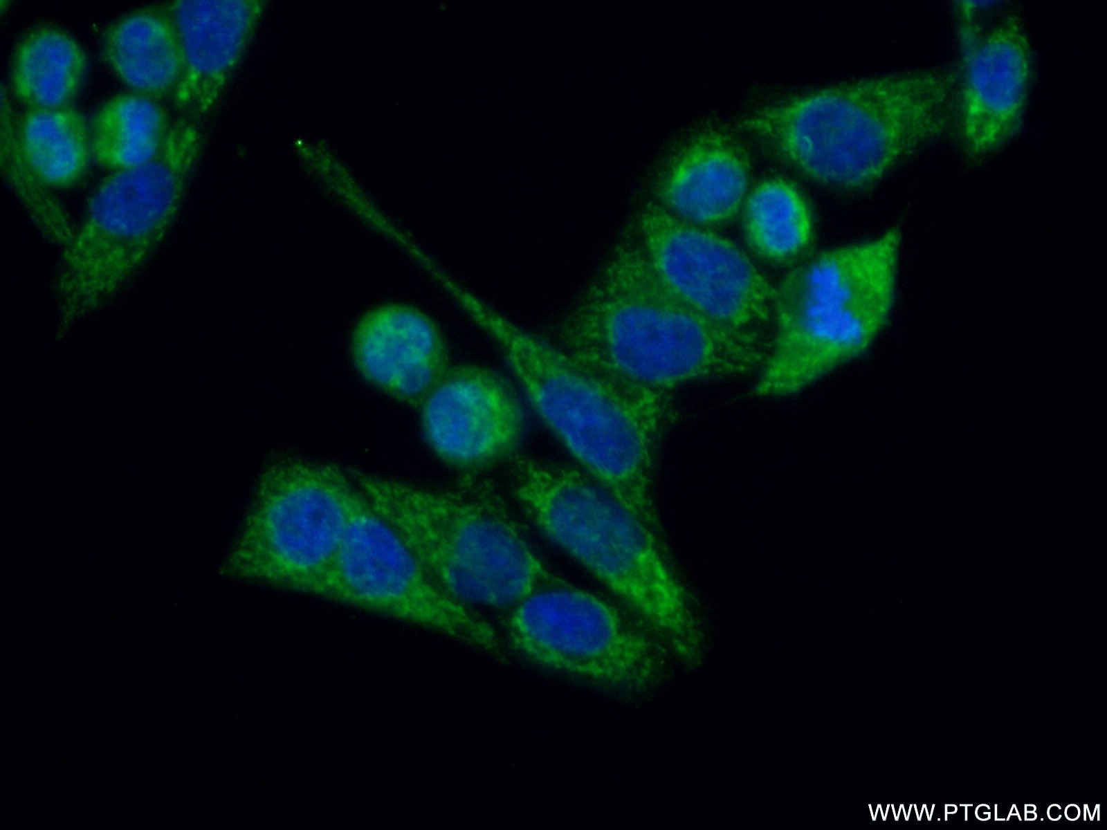 Immunofluorescence (IF) / fluorescent staining of HeLa cells using ARHGEF5 Polyclonal antibody (11379-1-AP)