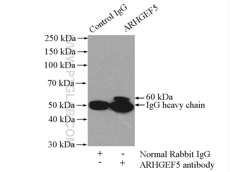 Immunoprecipitation (IP) experiment of mouse kidney tissue using ARHGEF5 Polyclonal antibody (11379-1-AP)