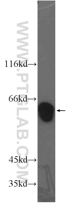 Western Blot (WB) analysis of rat kidney tissue using ARHGEF5 Polyclonal antibody (11379-1-AP)