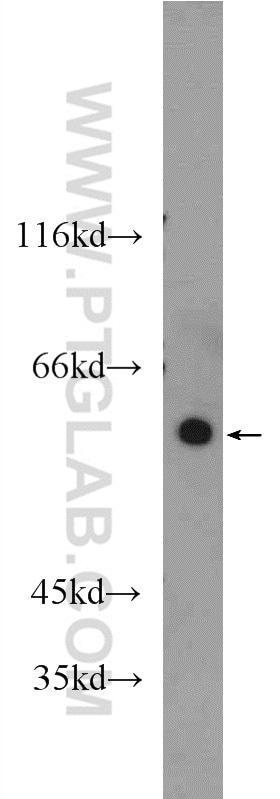 Western Blot (WB) analysis of mouse kidney tissue using ARHGEF5 Polyclonal antibody (11379-1-AP)