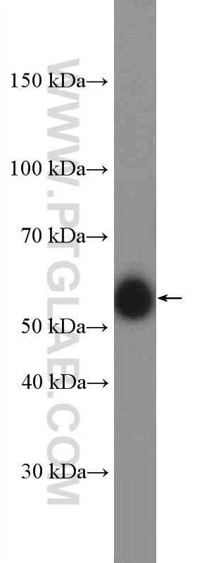 Western Blot (WB) analysis of HEK-293 cells using ARHGEF5 Polyclonal antibody (11379-1-AP)
