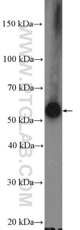 Western Blot (WB) analysis of mouse liver tissue using ARHGEF5 Polyclonal antibody (11379-1-AP)