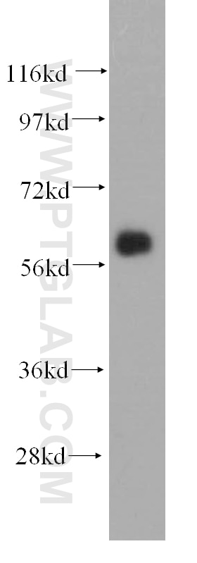 Western Blot (WB) analysis of human liver tissue using ARHGEF5 Polyclonal antibody (11379-1-AP)