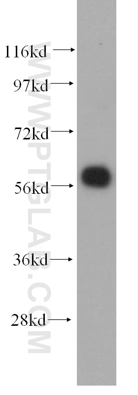 Western Blot (WB) analysis of MCF-7 cells using ARHGEF5 Polyclonal antibody (11379-1-AP)