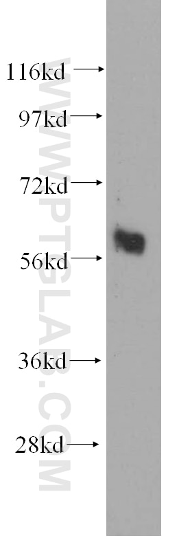 Western Blot (WB) analysis of human kidney tissue using ARHGEF5 Polyclonal antibody (11379-1-AP)