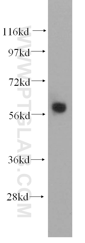 Western Blot (WB) analysis of HeLa cells using ARHGEF5 Polyclonal antibody (11379-1-AP)
