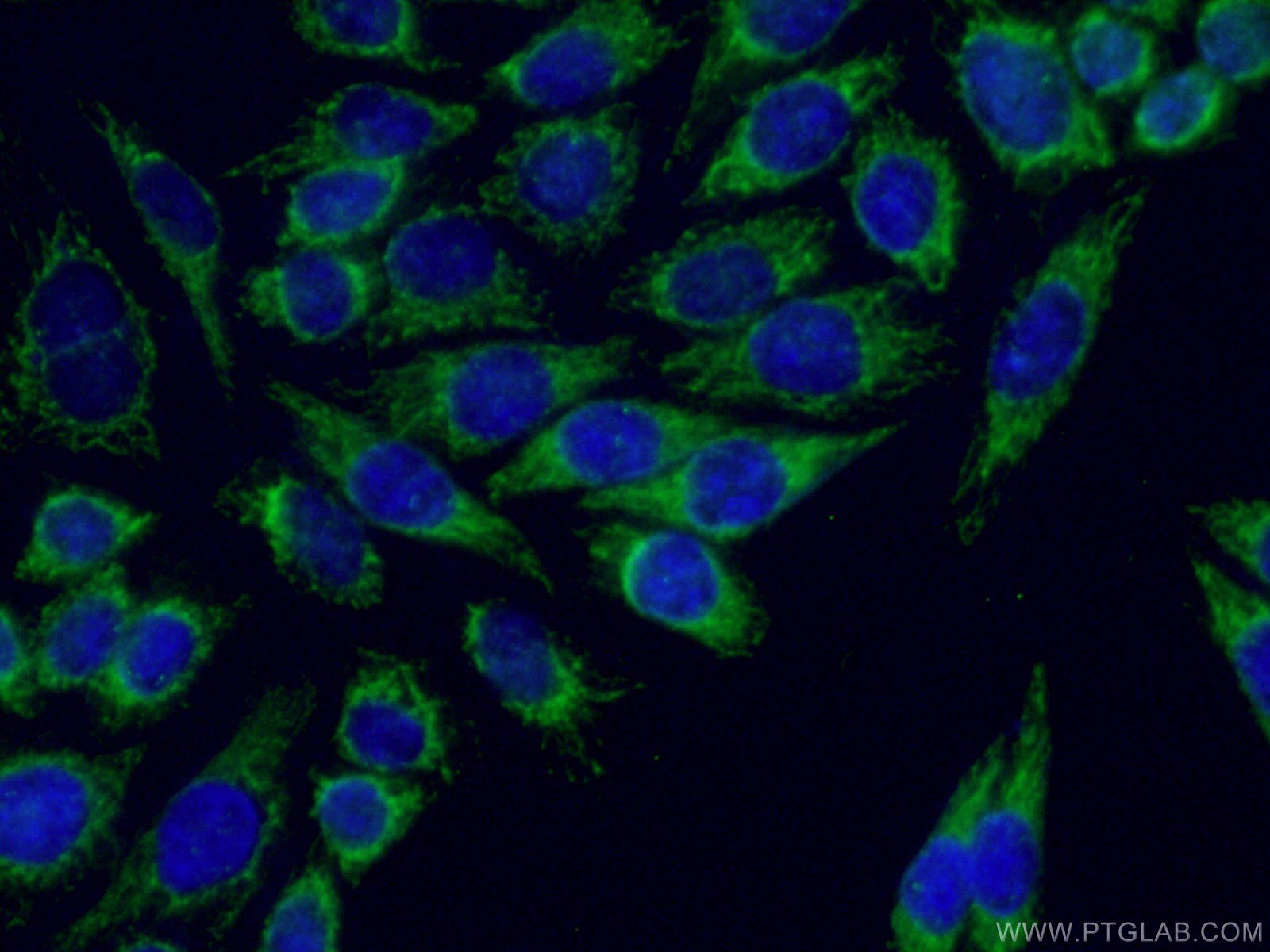 Immunofluorescence (IF) / fluorescent staining of HeLa cells using ARHGEF7 Polyclonal antibody (14092-1-AP)