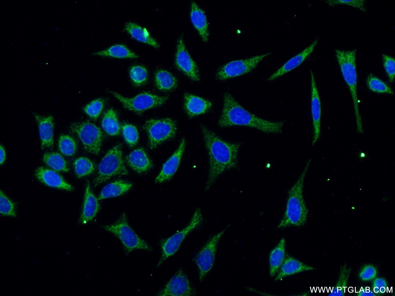 ARHGEF7 Polyclonal antibody