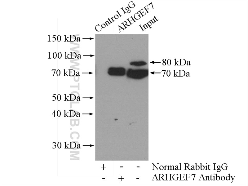 Immunoprecipitation (IP) experiment of HeLa cells using ARHGEF7 Polyclonal antibody (14092-1-AP)