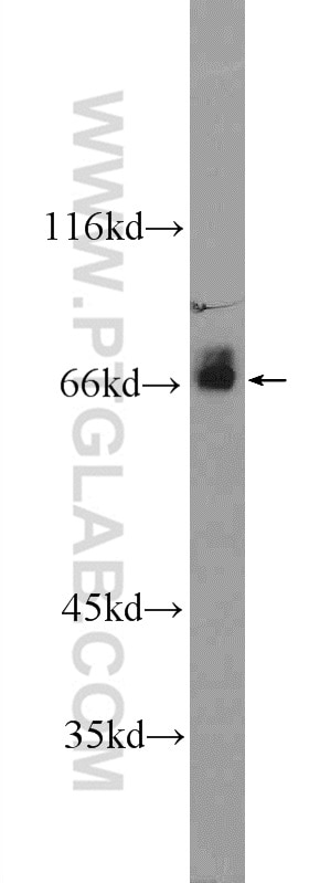 Western Blot (WB) analysis of Jurkat cells using ARHGEF7 Polyclonal antibody (14092-1-AP)