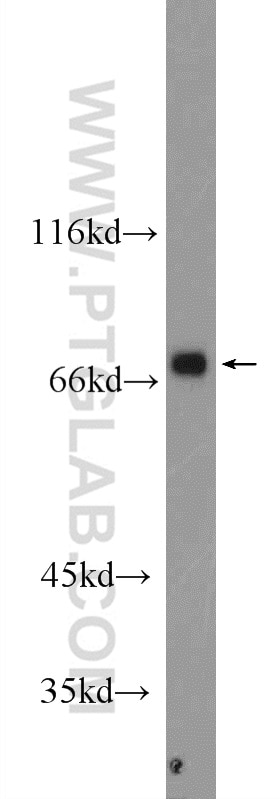 Western Blot (WB) analysis of NIH/3T3 cells using ARHGEF7 Polyclonal antibody (14092-1-AP)