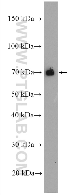 Western Blot (WB) analysis of PC-12 cells using ARHGEF7 Polyclonal antibody (14092-1-AP)