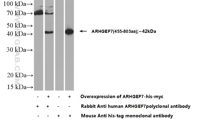 Western Blot (WB) analysis of Transfected HEK-293 cells using ARHGEF7 Polyclonal antibody (14092-1-AP)