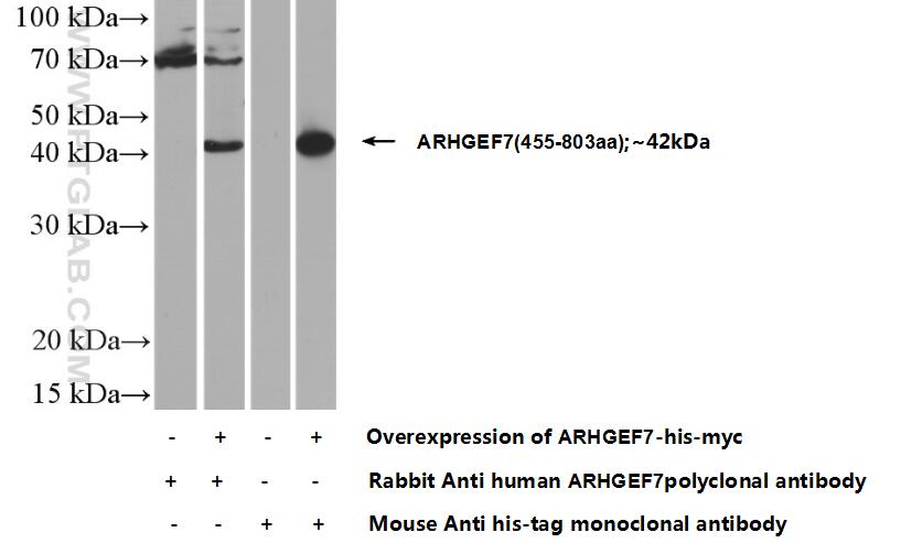 WB analysis of Transfected HEK-293 using 14092-1-AP