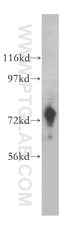 Western Blot (WB) analysis of mouse skeletal muscle tissue using ARHGEF7 Polyclonal antibody (14092-1-AP)