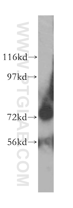 Western Blot (WB) analysis of K-562 cells using ARHGEF7 Polyclonal antibody (14092-1-AP)