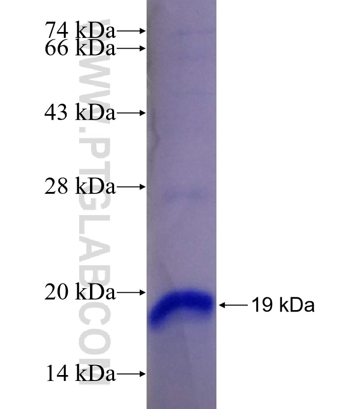 ARHGEF7 fusion protein Ag28842 SDS-PAGE