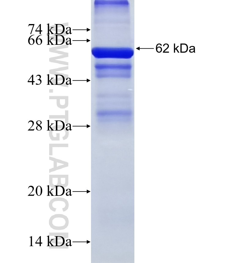 ARHGEF7 fusion protein Ag5223 SDS-PAGE