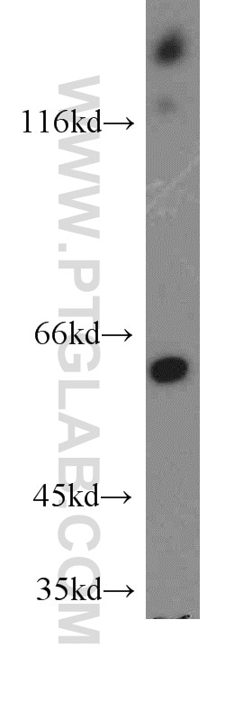 Western Blot (WB) analysis of HeLa cells using ARHGEF9-Specific Polyclonal antibody (20042-1-AP)