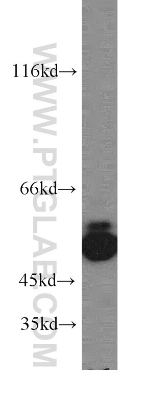Western Blot (WB) analysis of human brain tissue using ARHGEF9-Specific Polyclonal antibody (20042-1-AP)