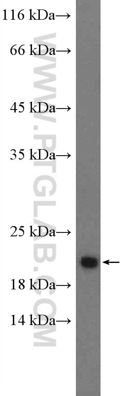 ARID1A Polyclonal antibody