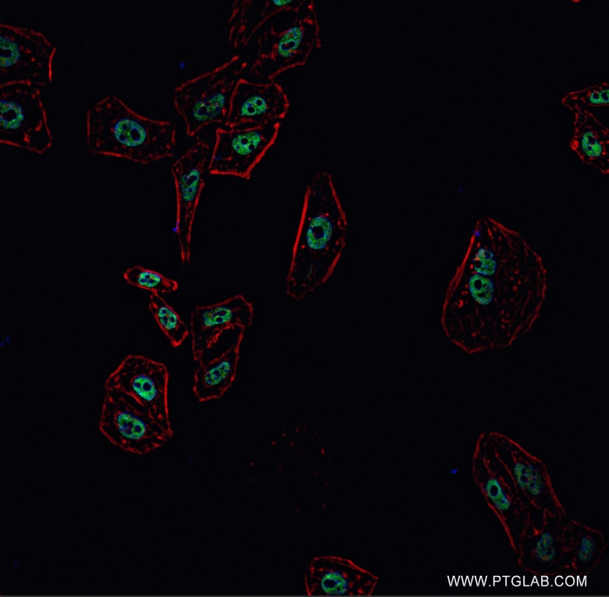 Immunofluorescence (IF) / fluorescent staining of HepG2 cells using ARID1B Recombinant antibody (82979-1-RR)