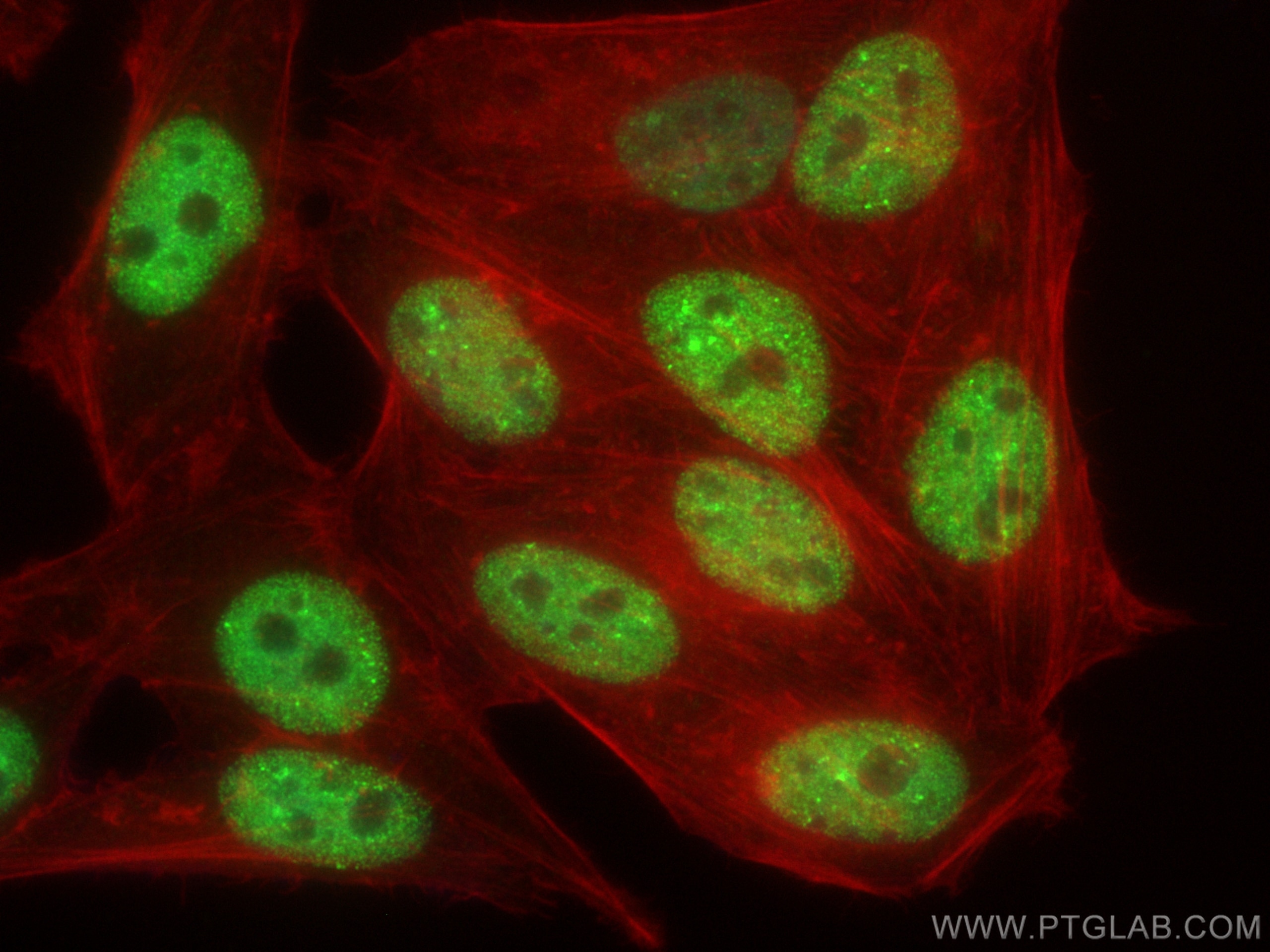 Immunofluorescence (IF) / fluorescent staining of HepG2 cells using ARID1B Recombinant antibody (82979-1-RR)
