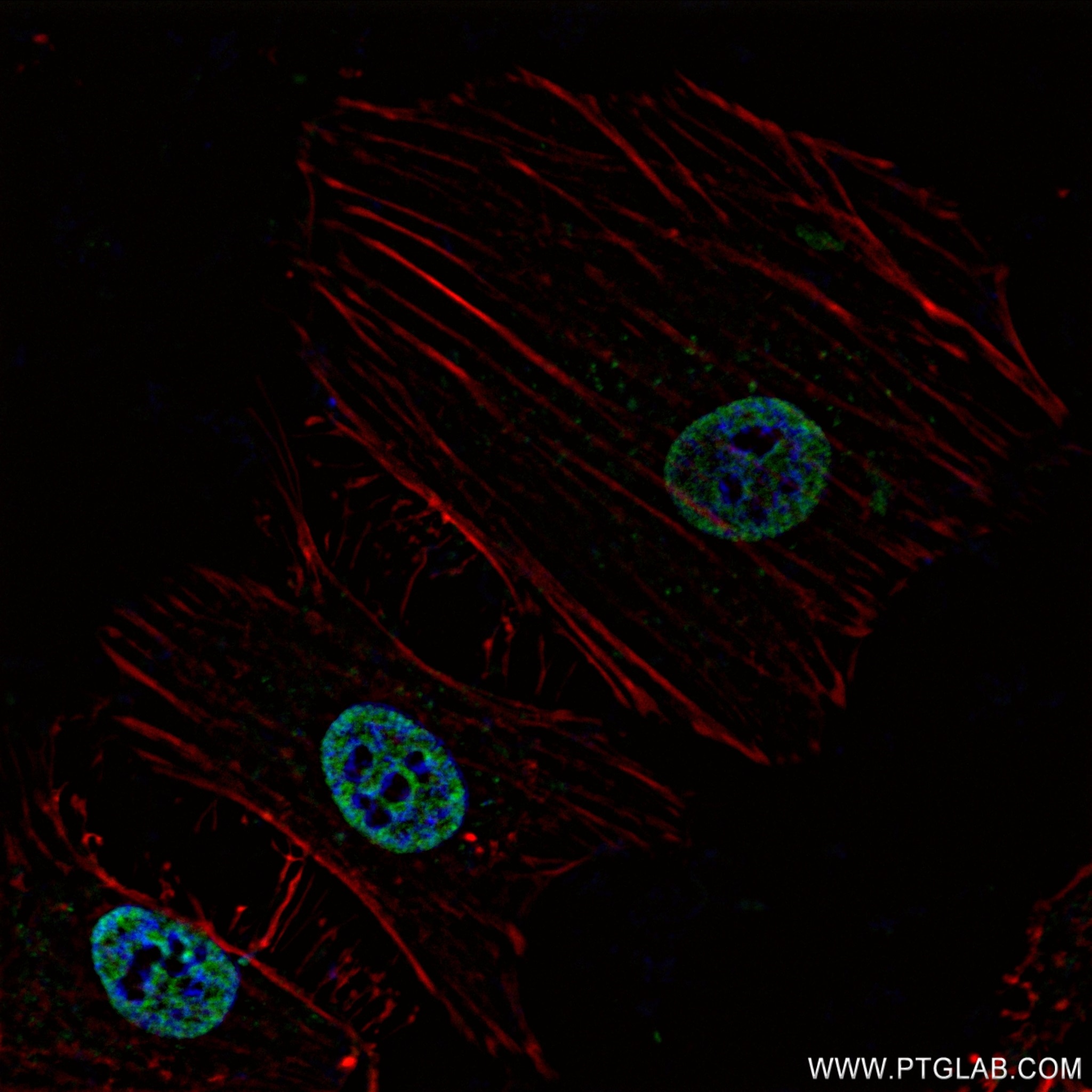 Immunofluorescence (IF) / fluorescent staining of HeLa cells using ARID1B Recombinant antibody (82979-6-RR)