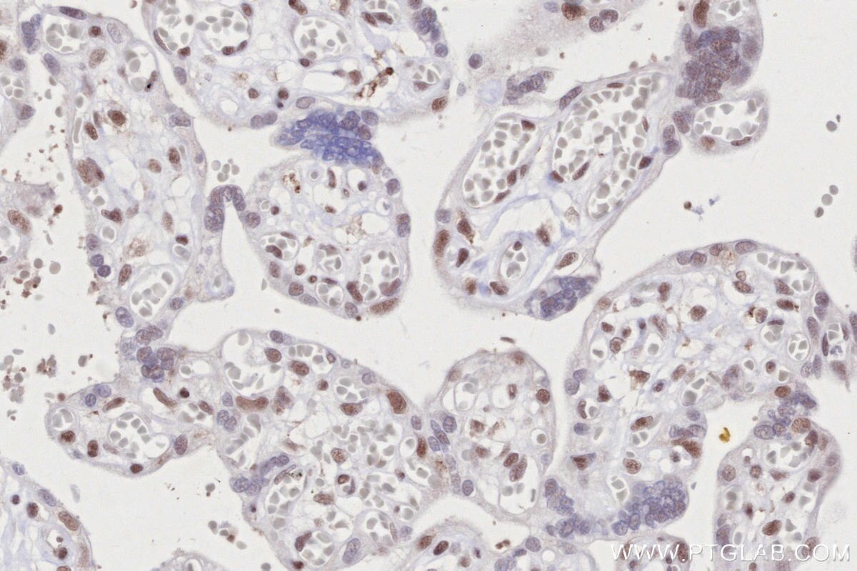 IHC staining of human placenta using 82979-6-RR Immunohistochemistry (IHC) staining of human placenta tissue using ARID1B Recombinant monoclonal antibody (82979-6-RR)