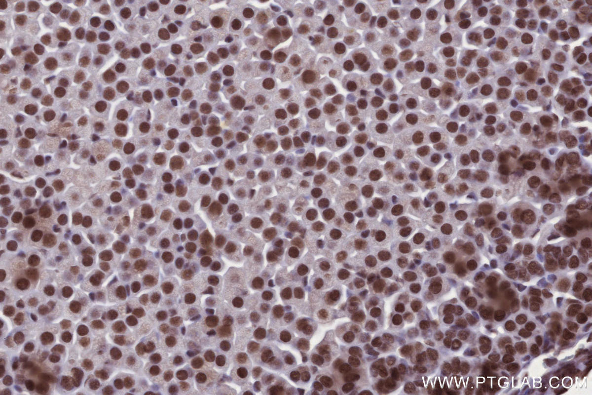IHC staining of mouse adrenal gland using 82979-6-RR Immunohistochemistry (IHC) staining of mouse adrenal gland tissue using ARID1B Recombinant monoclonal antibody (82979-6-RR)