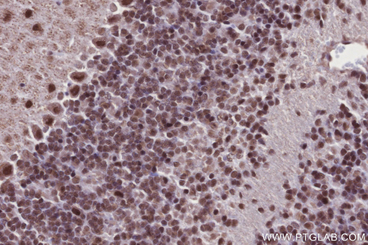IHC staining of mouse cerebellum using 82979-6-RR Immunohistochemistry (IHC) staining of mouse cerebellum tissue using ARID1B Recombinant monoclonal antibody (82979-6-RR)