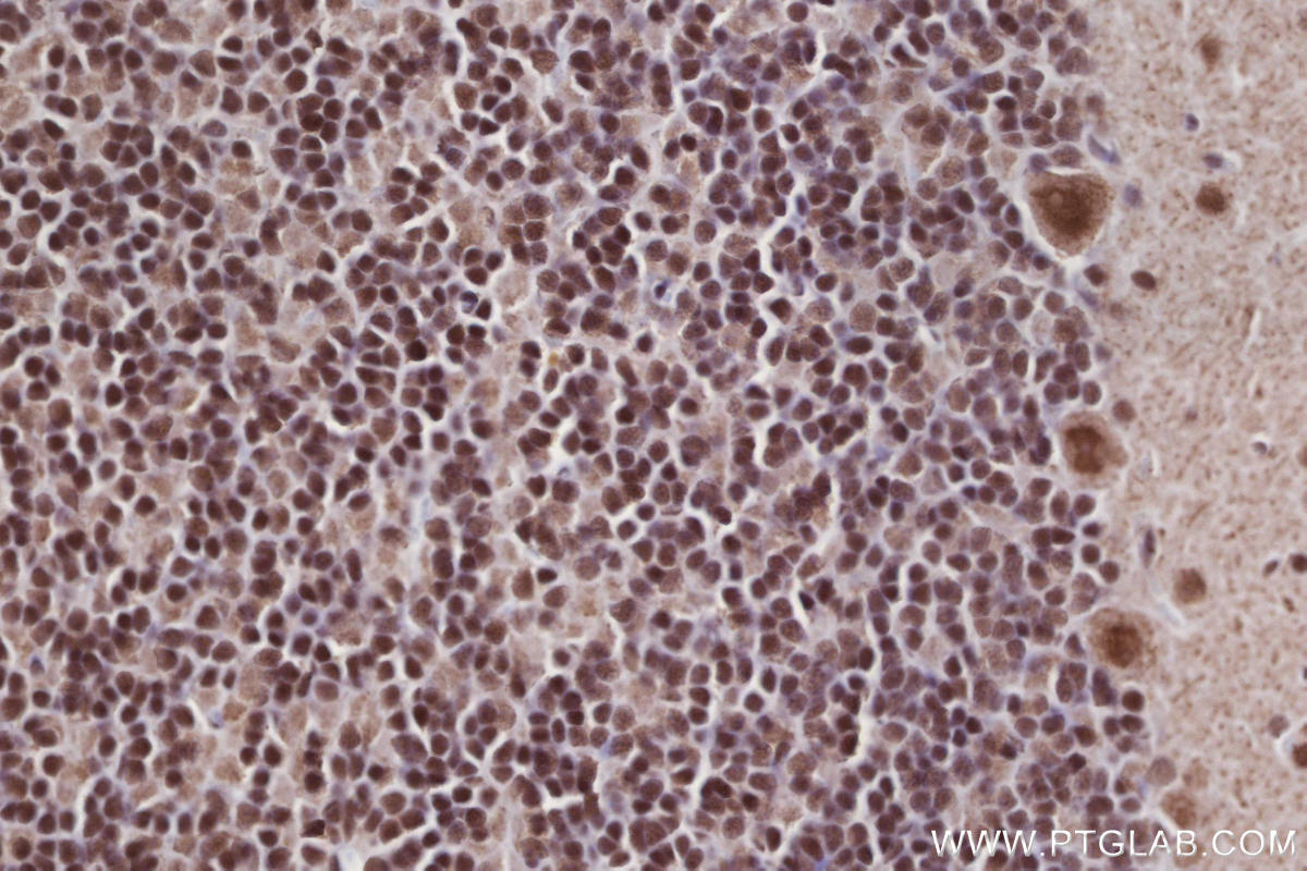 IHC staining of rat cerebellum using 82979-6-RR Immunohistochemistry (IHC) staining of rat cerebellum tissue using ARID1B Recombinant monoclonal antibody (82979-6-RR)