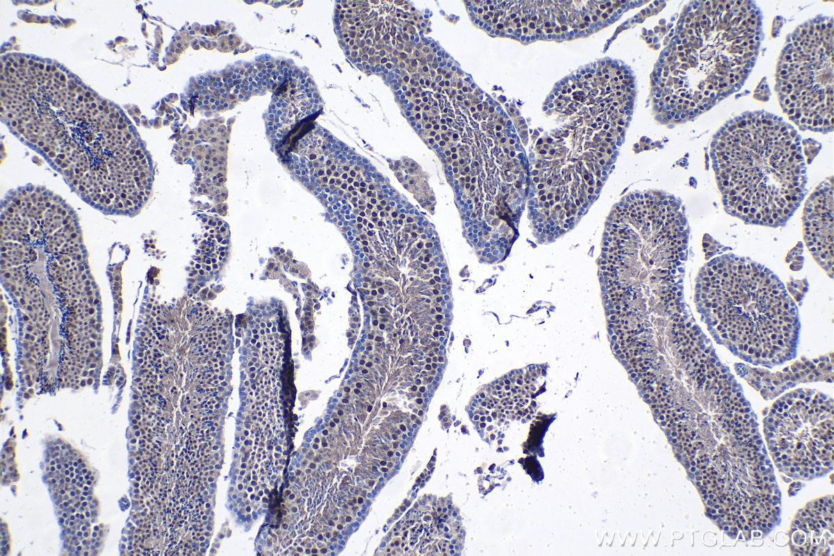 Immunohistochemistry (IHC) staining of mouse testis tissue using ARID2 Polyclonal antibody (23406-1-AP)