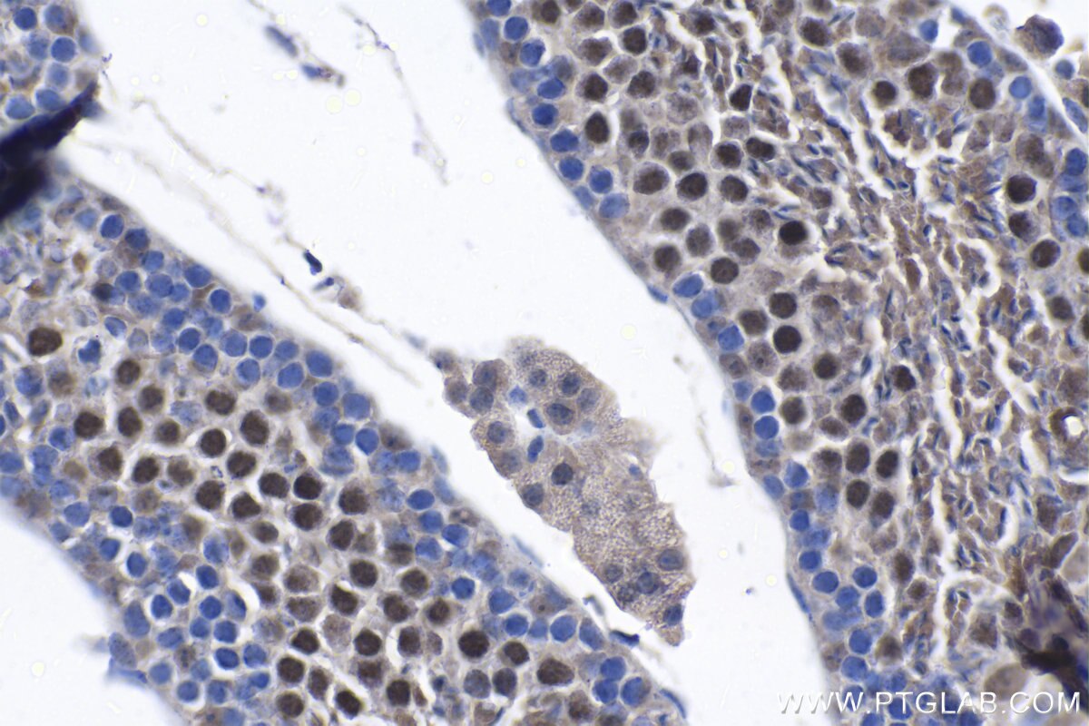 Immunohistochemistry (IHC) staining of mouse testis tissue using ARID2 Polyclonal antibody (23406-1-AP)
