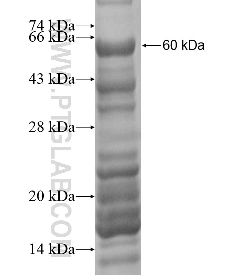 ARID2 fusion protein Ag19968 SDS-PAGE